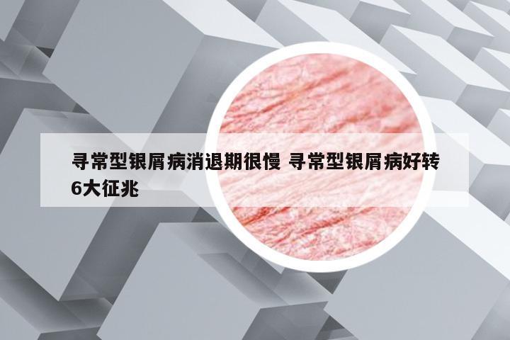 寻常型银屑病消退期很慢 寻常型银屑病好转6大征兆