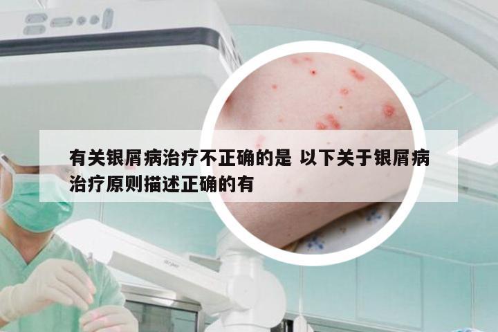 有关银屑病治疗不正确的是 以下关于银屑病治疗原则描述正确的有