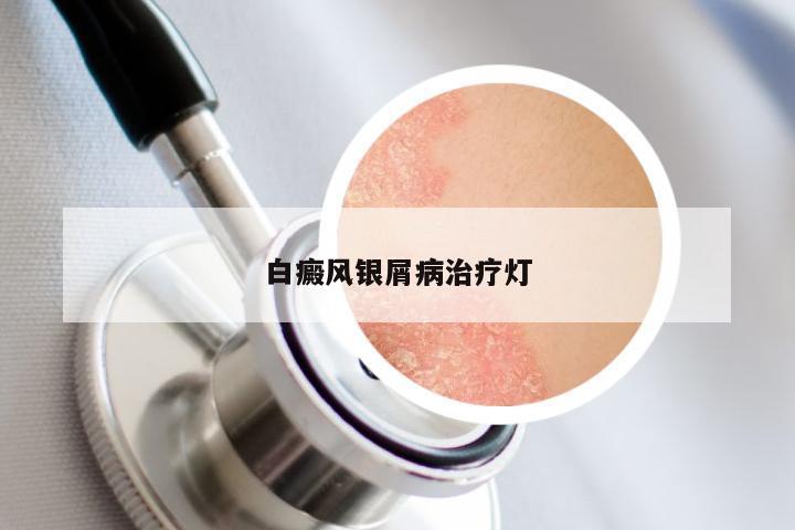 白癜风银屑病治疗灯