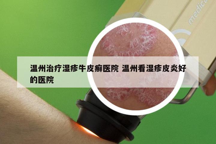 温州治疗湿疹牛皮癣医院 温州看湿疹皮炎好的医院