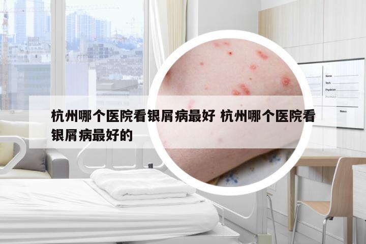 杭州哪个医院看银屑病最好 杭州哪个医院看银屑病最好的