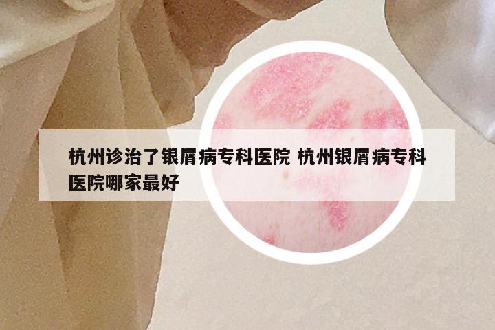 杭州诊治了银屑病专科医院 杭州银屑病专科医院哪家最好