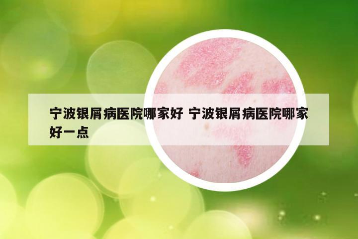 宁波银屑病医院哪家好 宁波银屑病医院哪家好一点