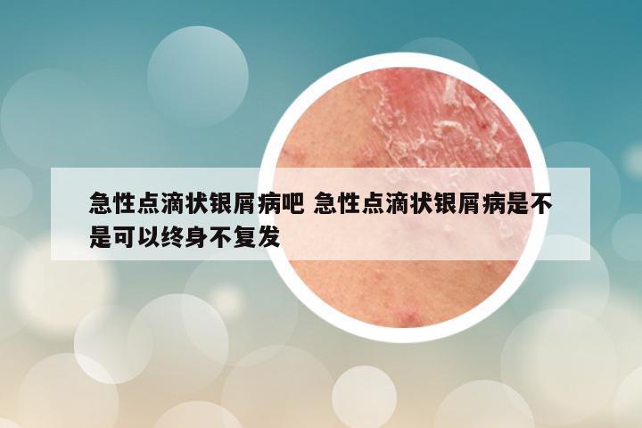 急性点滴状银屑病吧 急性点滴状银屑病是不是可以终身不复发