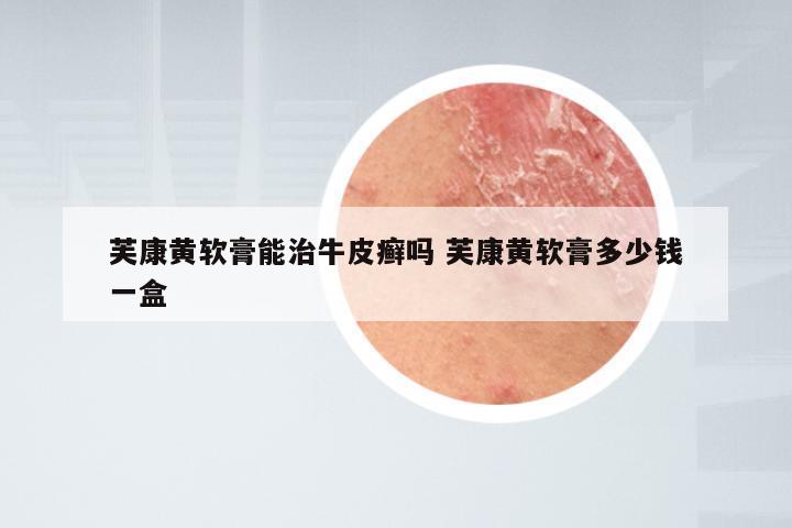 芙康黄软膏能治牛皮癣吗 芙康黄软膏多少钱一盒