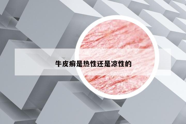 牛皮癣是热性还是凉性的
