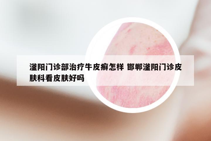 滏阳门诊部治疗牛皮癣怎样 邯郸滏阳门诊皮肤科看皮肤好吗