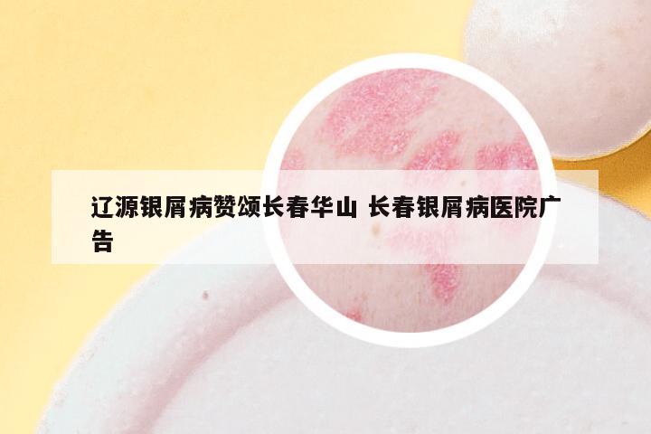 辽源银屑病赞颂长春华山 长春银屑病医院广告