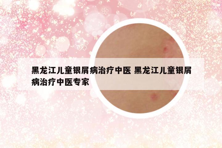 黑龙江儿童银屑病治疗中医 黑龙江儿童银屑病治疗中医专家