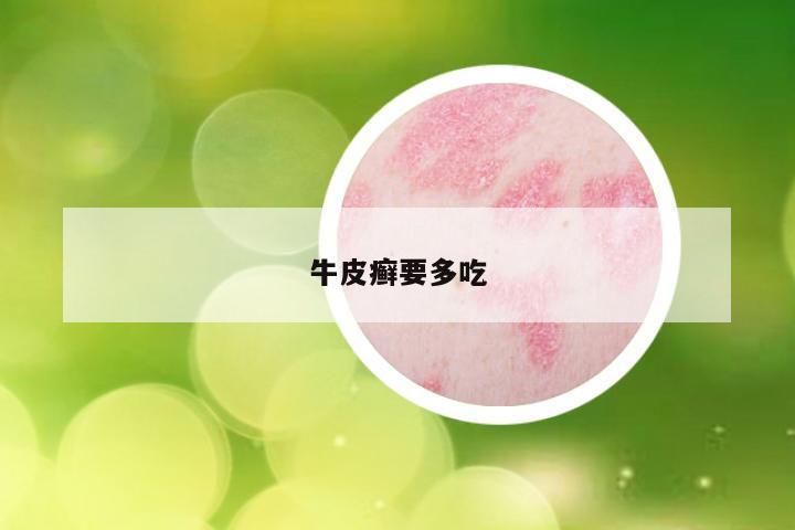 牛皮癣要多吃