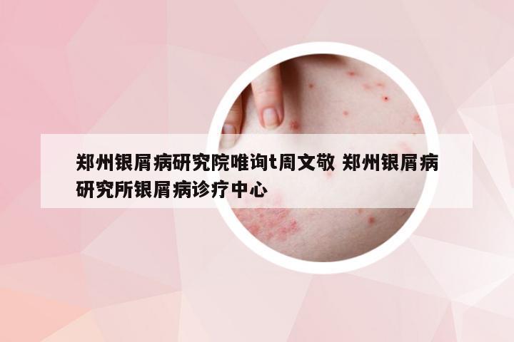 郑州银屑病研究院唯询t周文敬 郑州银屑病研究所银屑病诊疗中心