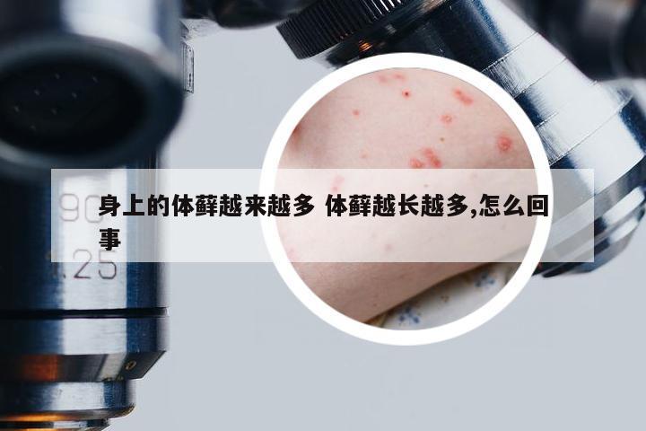身上的体藓越来越多 体藓越长越多,怎么回事