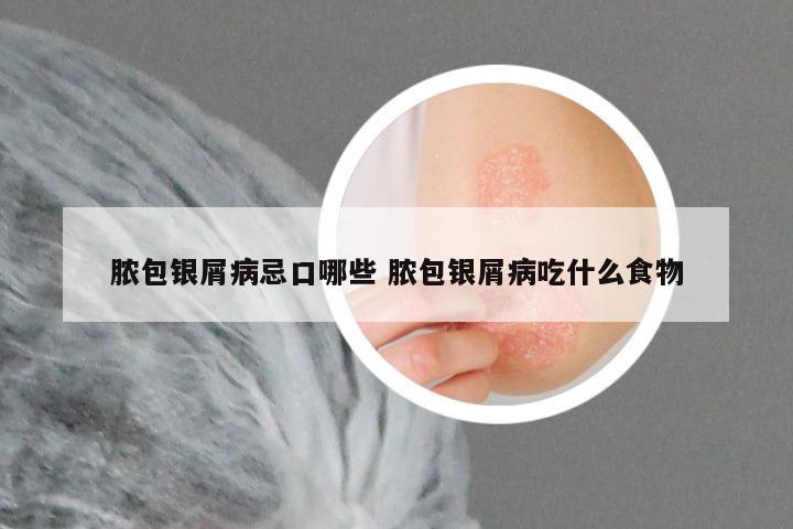 脓包银屑病忌口哪些 脓包银屑病吃什么食物