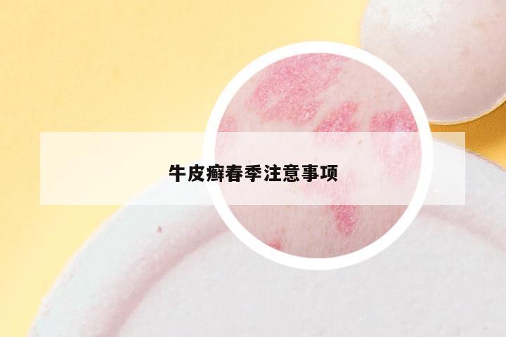 牛皮癣春季注意事项