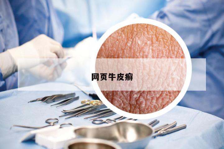 网页牛皮癣