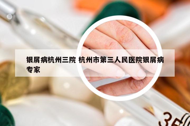 银屑病杭州三院 杭州市第三人民医院银屑病专家