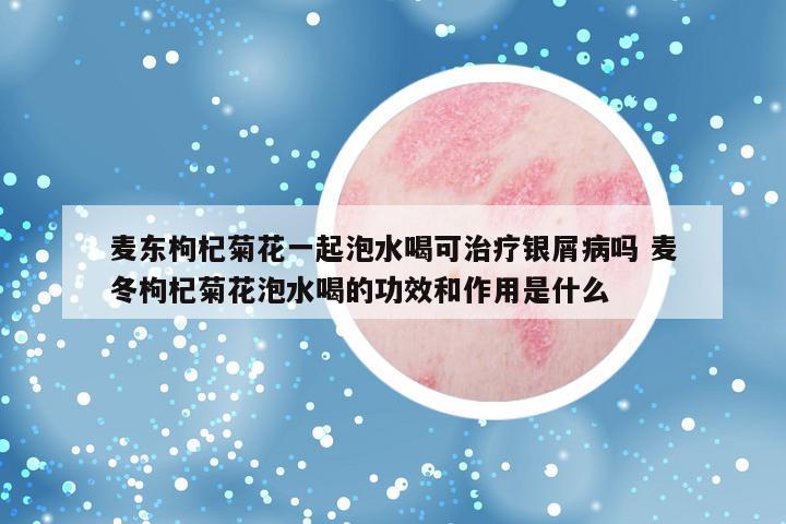 麦东枸杞菊花一起泡水喝可治疗银屑病吗 麦冬枸杞菊花泡水喝的功效和作用是什么