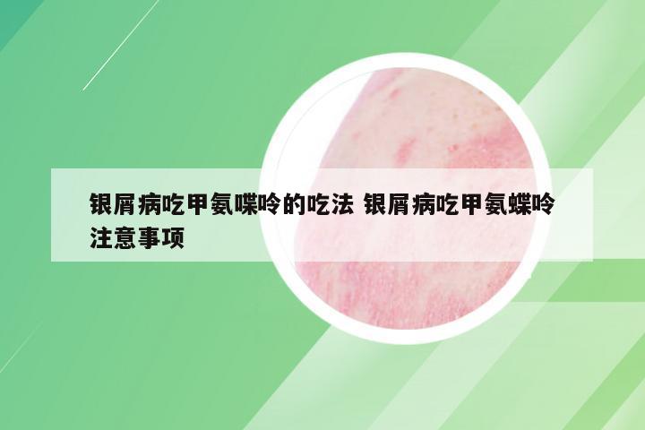 银屑病吃甲氨喋呤的吃法 银屑病吃甲氨蝶呤注意事项