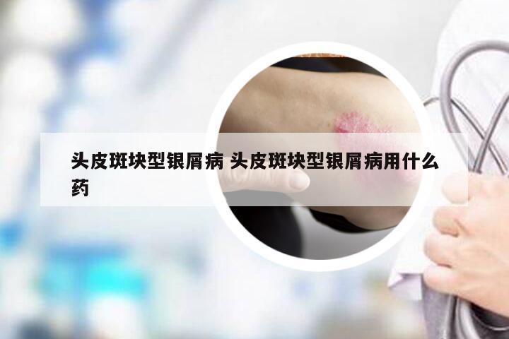 头皮斑块型银屑病 头皮斑块型银屑病用什么药