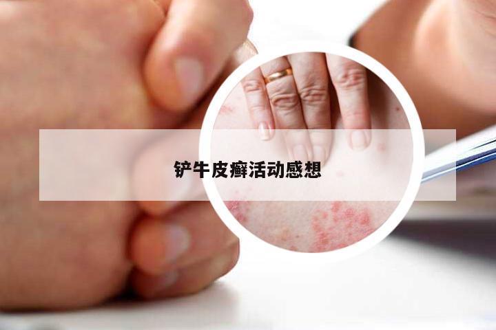 铲牛皮癣活动感想