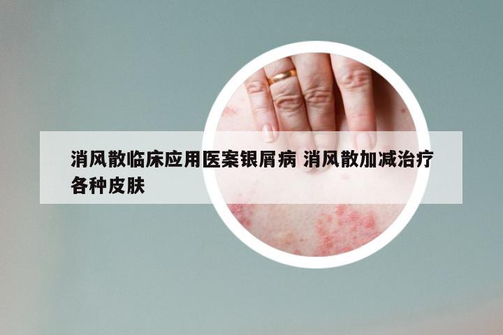 消风散临床应用医案银屑病 消风散加减治疗各种皮肤