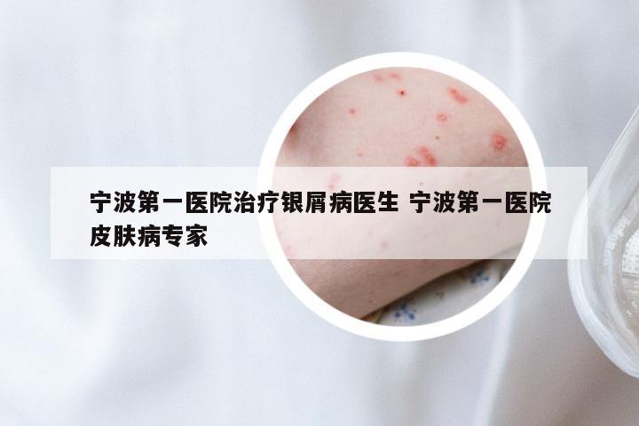 宁波第一医院治疗银屑病医生 宁波第一医院皮肤病专家