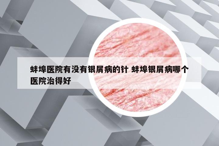蚌埠医院有没有银屑病的针 蚌埠银屑病哪个医院治得好