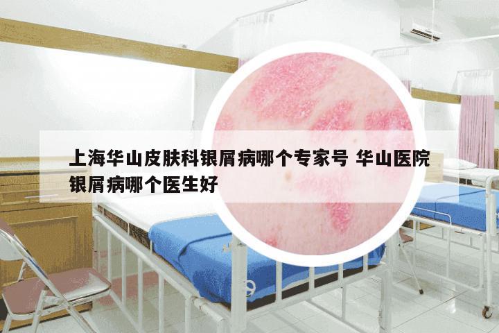 上海华山皮肤科银屑病哪个专家号 华山医院银屑病哪个医生好