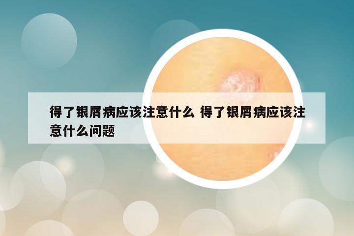 得了银屑病应该注意什么 得了银屑病应该注意什么问题