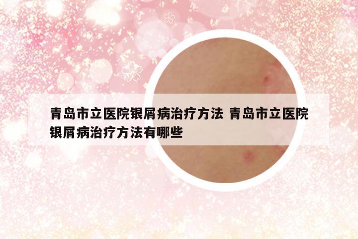 青岛市立医院银屑病治疗方法 青岛市立医院银屑病治疗方法有哪些