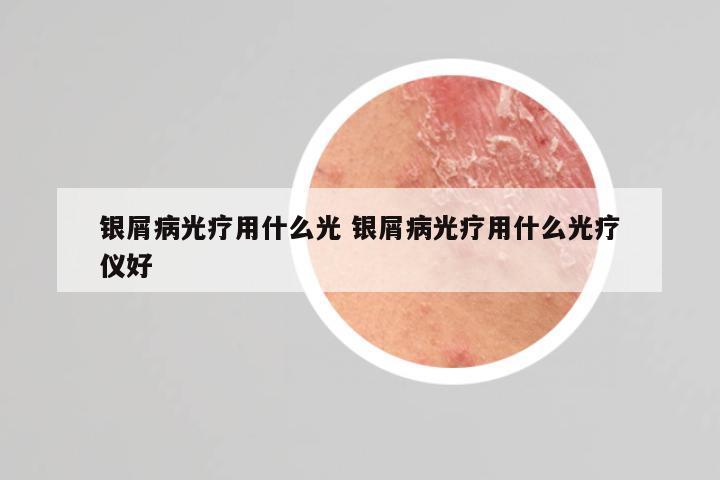 银屑病光疗用什么光 银屑病光疗用什么光疗仪好