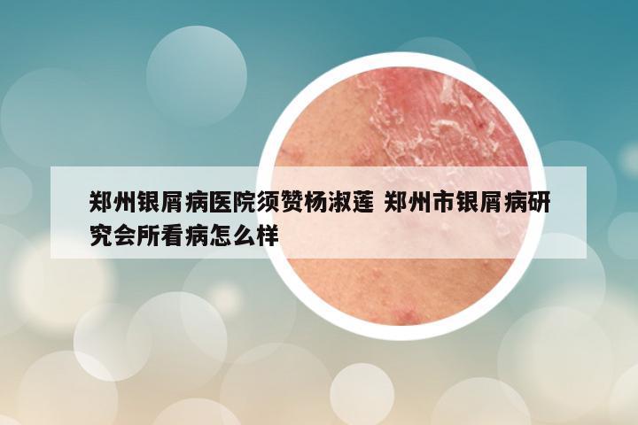 郑州银屑病医院须赞杨淑莲 郑州市银屑病研究会所看病怎么样