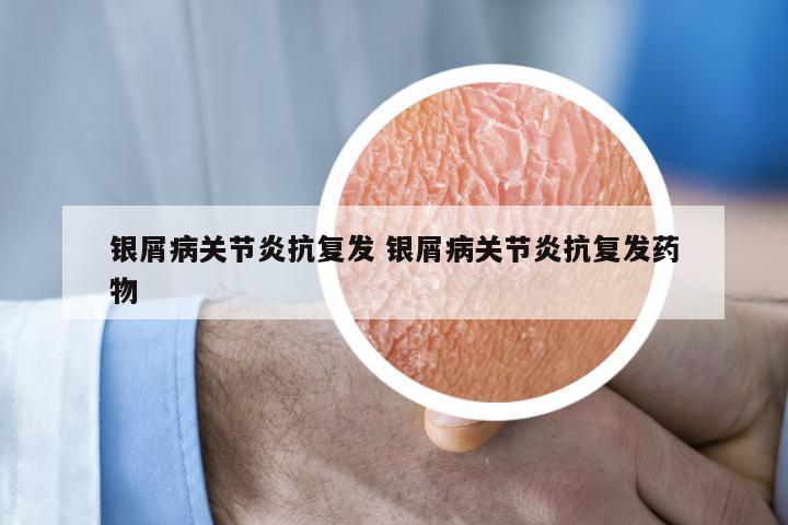 银屑病关节炎抗复发 银屑病关节炎抗复发药物