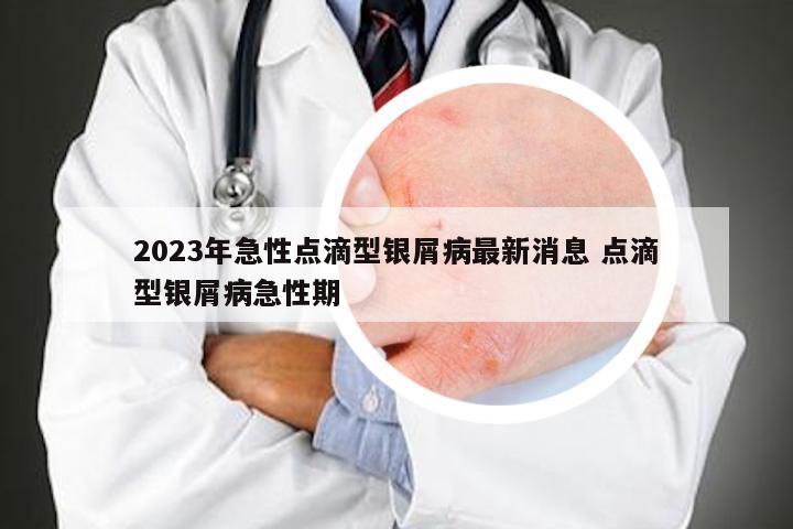 2023年急性点滴型银屑病最新消息 点滴型银屑病急性期
