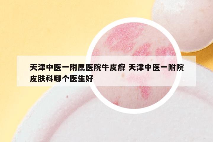 天津中医一附属医院牛皮癣 天津中医一附院皮肤科哪个医生好