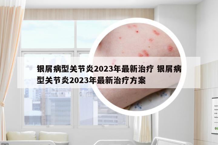 银屑病型关节炎2023年最新治疗 银屑病型关节炎2023年最新治疗方案