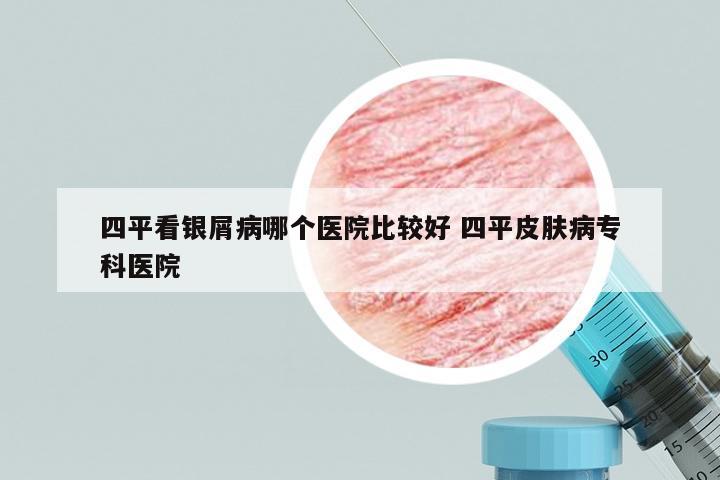 四平看银屑病哪个医院比较好 四平皮肤病专科医院