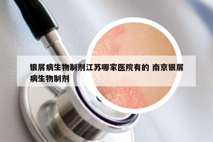 银屑病生物制剂江苏哪家医院有的 南京银屑病生物制剂