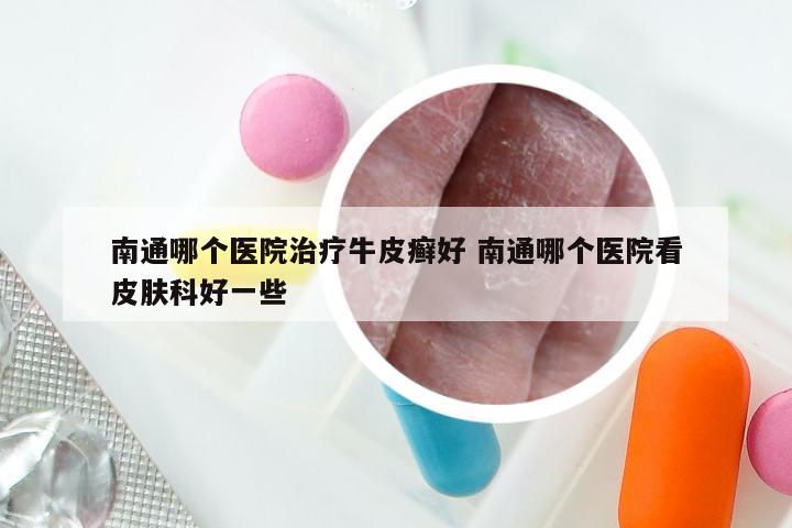 南通哪个医院治疗牛皮癣好 南通哪个医院看皮肤科好一些