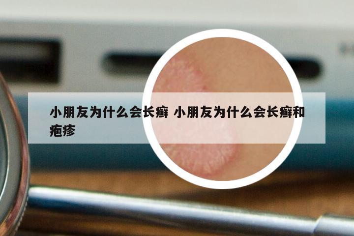 小朋友为什么会长癣 小朋友为什么会长癣和疱疹