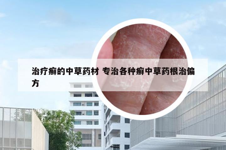 治疗癣的中草药材 专治各种癣中草药根治偏方
