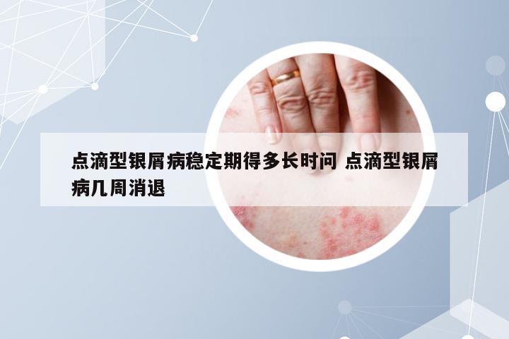 点滴型银屑病稳定期得多长时问 点滴型银屑病几周消退