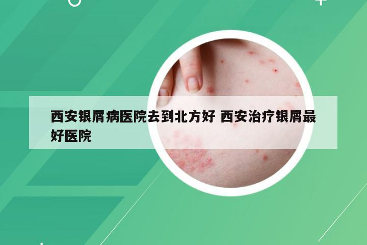 西安银屑病医院去到北方好 西安治疗银屑最好医院