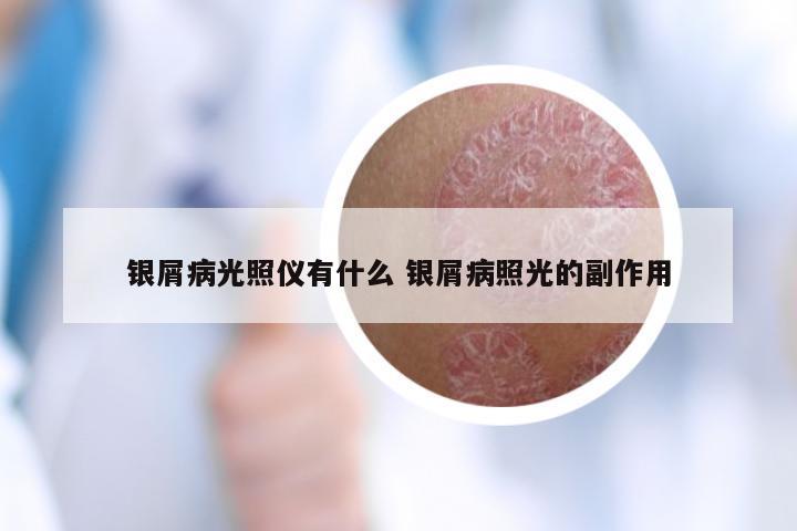 银屑病光照仪有什么 银屑病照光的副作用