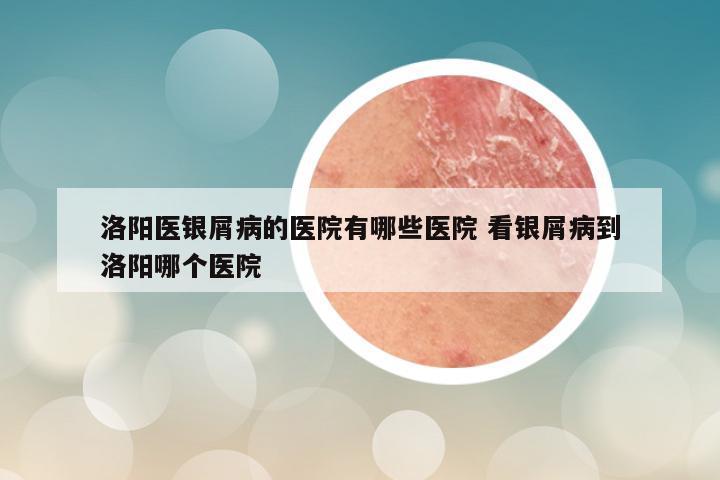 洛阳医银屑病的医院有哪些医院 看银屑病到洛阳哪个医院