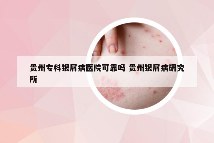 贵州专科银屑病医院可靠吗 贵州银屑病研究所
