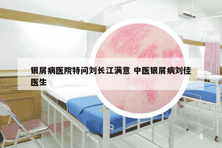 银屑病医院特问刘长江满意 中医银屑病刘佳医生