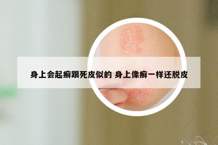 身上会起癣跟死皮似的 身上像癣一样还脱皮