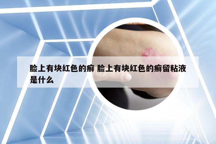 脸上有块红色的癣 脸上有块红色的癣留粘液是什么
