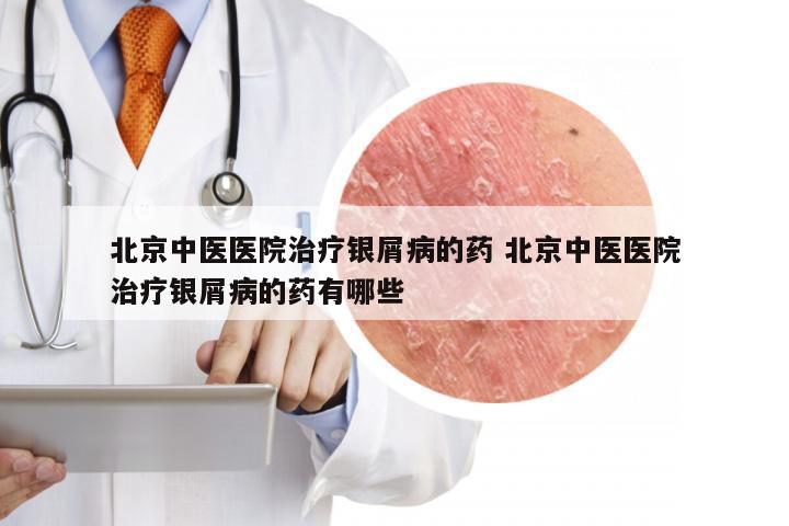北京中医医院治疗银屑病的药 北京中医医院治疗银屑病的药有哪些